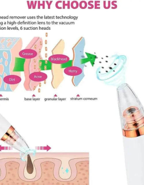 Diagram explaining the use of a blackhead remover with text about technology and suction levels.

