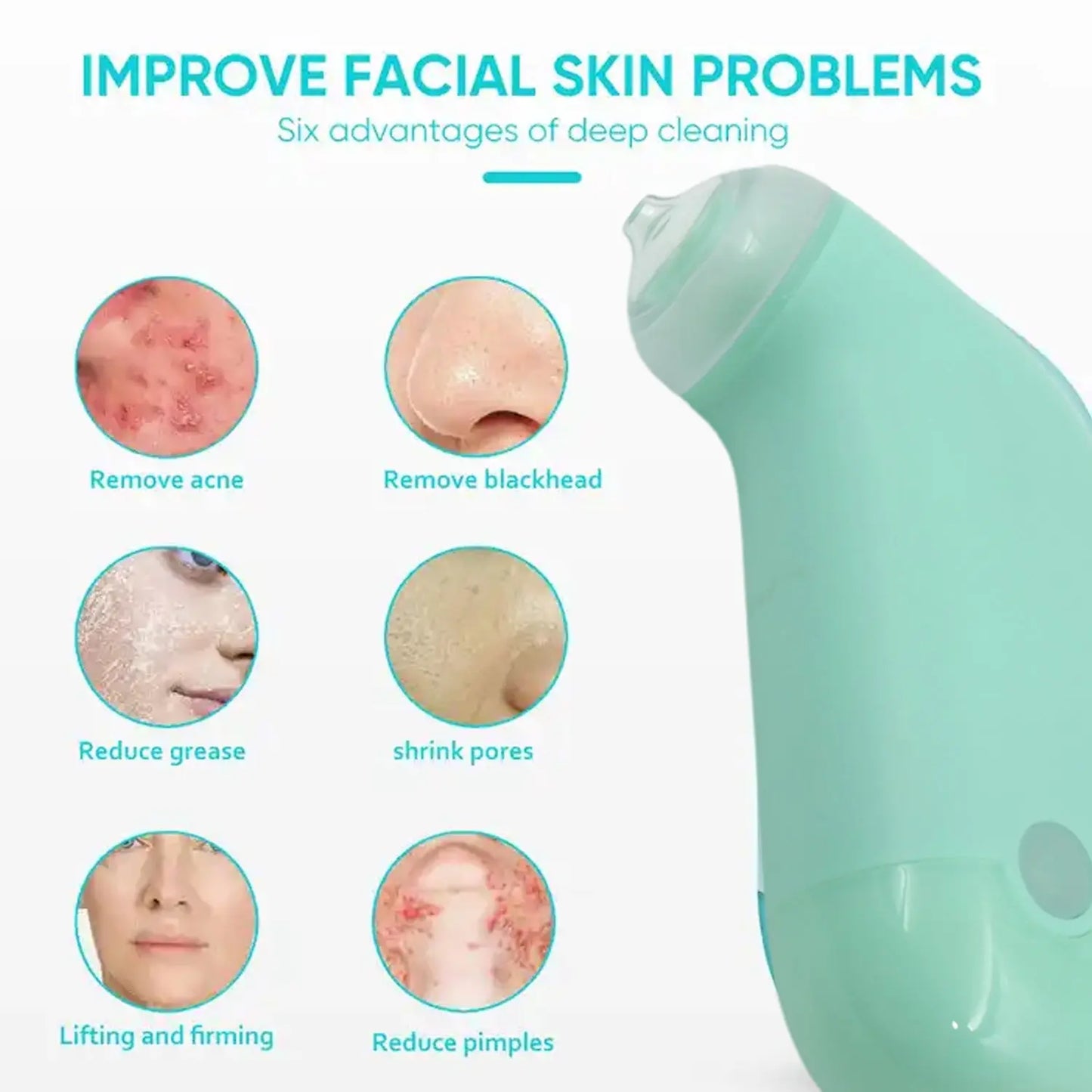 Vacuum Blackhead Remover – Deep Pore Cleanser & Facial Lifting Massager | Mini Handheld Spot Reduction Tool for Skincare - Chestore
